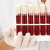مكملات الحديد الفعالة لفقر الدم ما يجب تناوله لعلاج فقر الدم