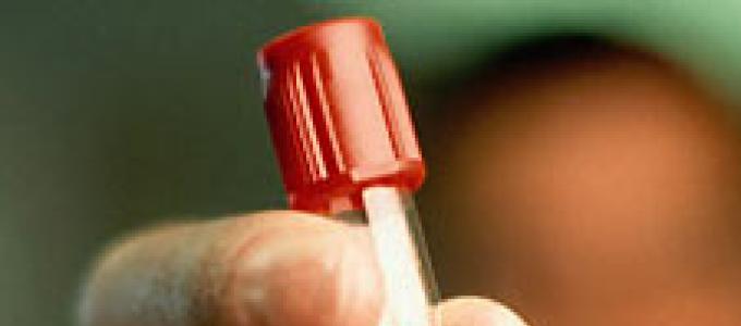 كيفية الاستعداد لاختبارات التهاب الكبد؟