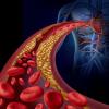 血栓塞栓症：症状、原因、分類、診断、治療